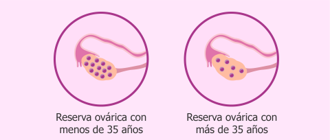 https://www.reproduccionasistida.org/reserva-ovarica/